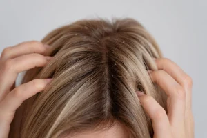 Cabelo com caspa? Dicas práticas para tratar com GA.MA Italy!
